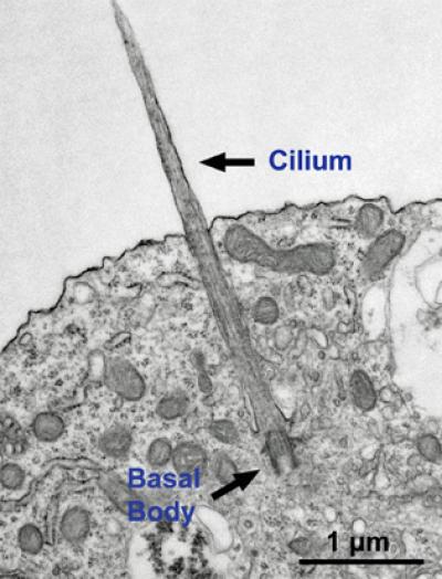 Joubert Syndrome --  Cilia
