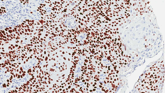 Squamous cells