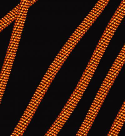 Structure of Soybean Mosaic Virus