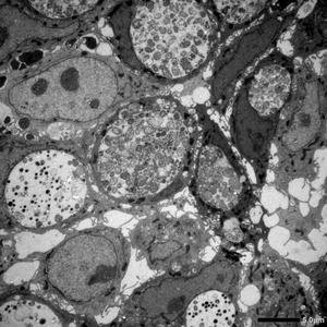 Different Chlamydia Forms in Human Intestinal Cells