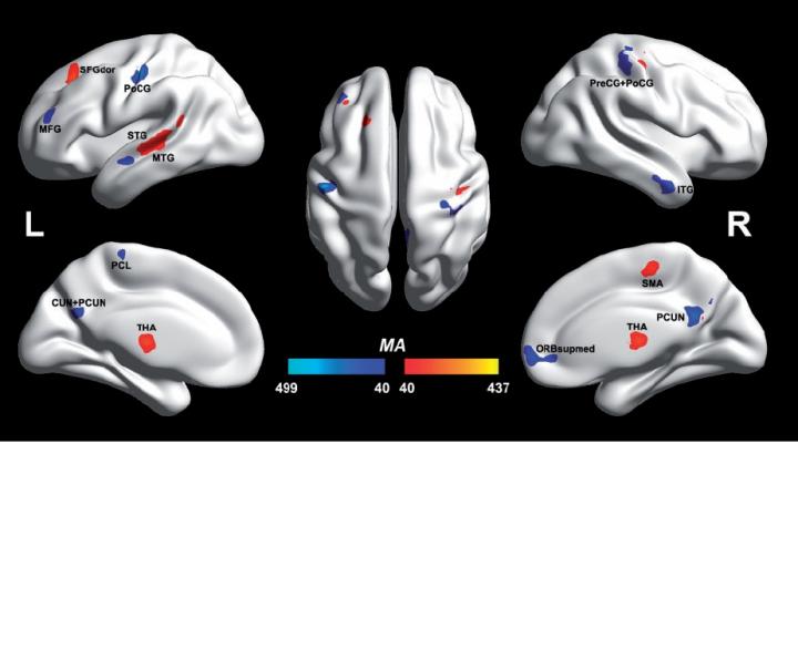 Brain Model with Regions of Interest