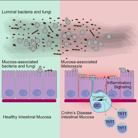 Fungi and Crohn's