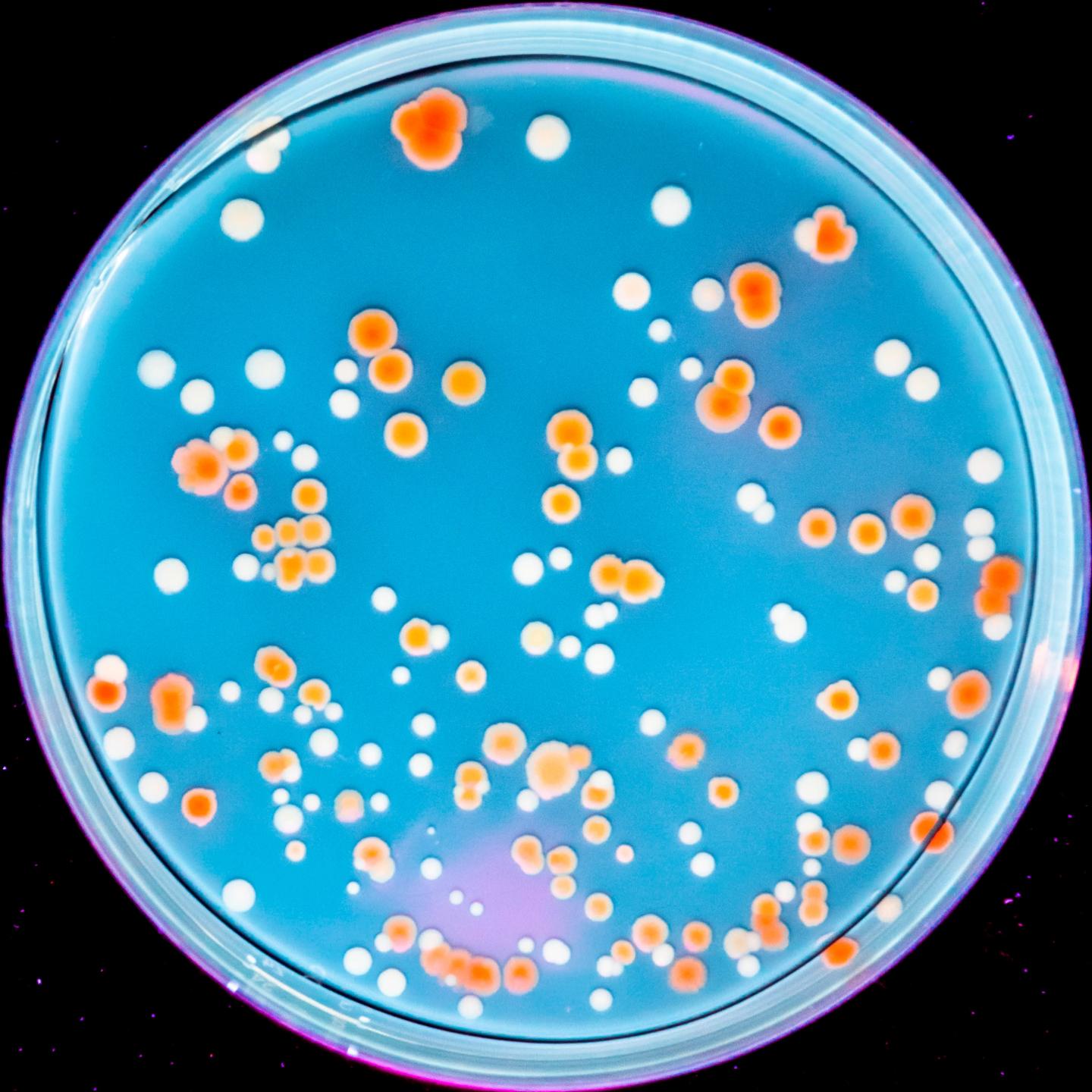 Bacterial Colonies IMAGE EurekAlert Science News Releases