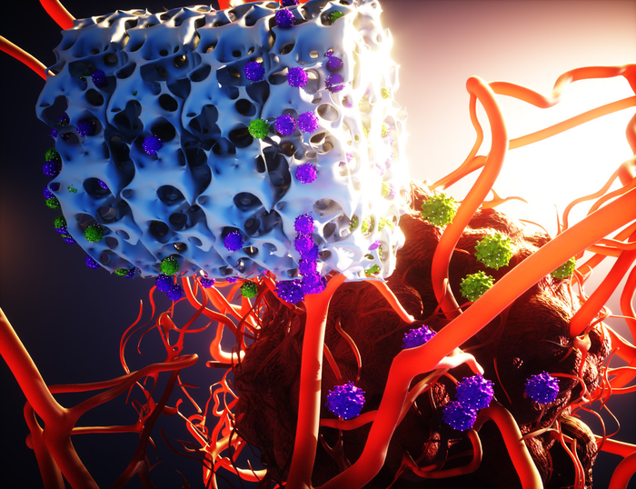 A bioinstructive scaffold (white) produces and releases genetically reprogrammed T cells that target and destroy a growing tumor.