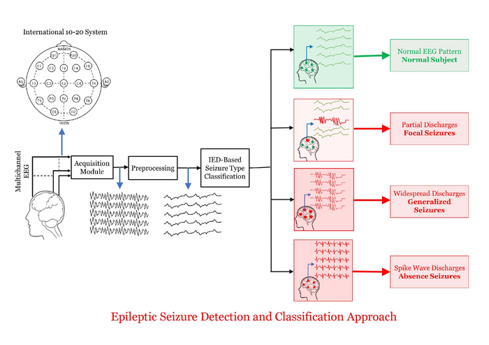 Detecting Seizures And Interpreting EEGs Th EurekAlert   Public