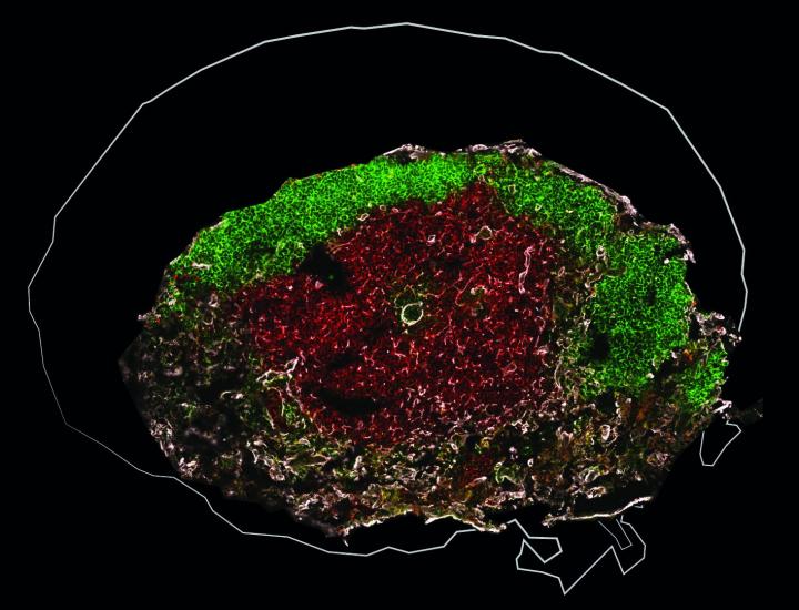 How Intestinal Worms Hinder Tuberculosis Vaccination