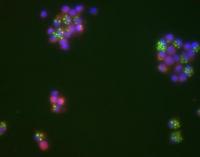 Macrophages -- Treated With Regulatory T Cells