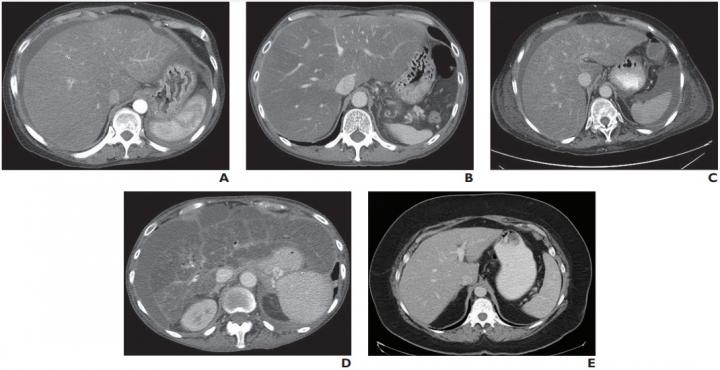 Examples of True-Positive, False-Positive, and False-Negative Assessments of NASH