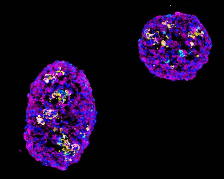 Beta Cell Cluster After Enrichment Process