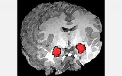 New Study Supports the Role of a Brain Region Called the Amygdala in Processing Anxiety