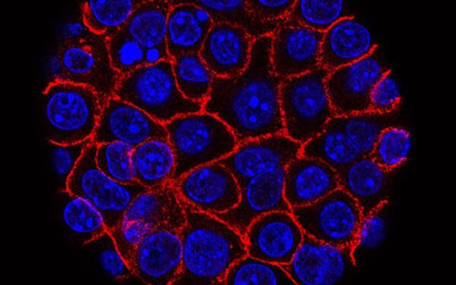 Pancreatic Cancer Cell, National Cancer Institute