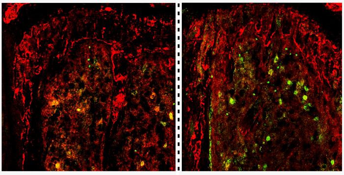 TET2 gene deficiency fuels development of acute myeloid leukemia