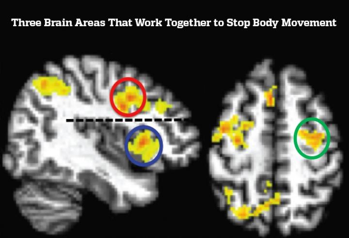 Brain Stop Action fMRI