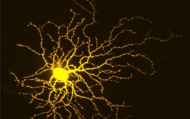 Retinal ganglion cell, University of California San Diego