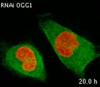 Silencing Gene Hinders Cell Division