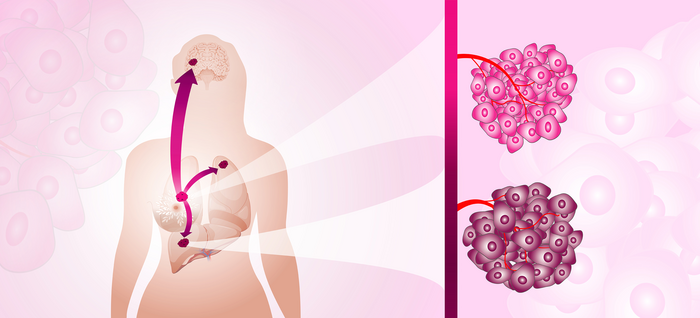 Metastatic tumors adapt their metabolism to the tissue in which they grow.