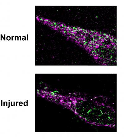 Beta-Arrestin2 localizes with eNOS in healthy cells