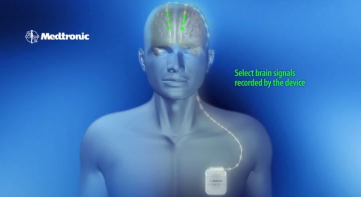 Activa PC+S Animation