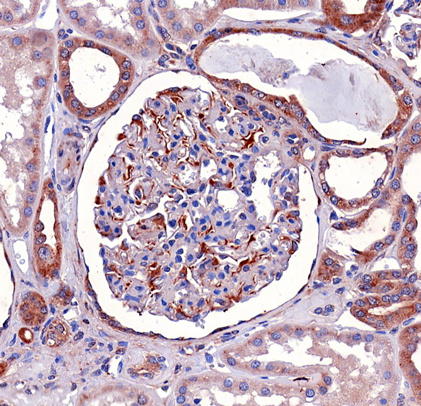 SHIP2 is Expressed in the Kidney
