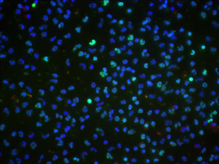 Immotile <i>P. aeruginosa</i>