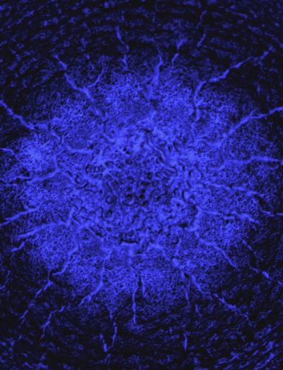 Resolidification Patterns