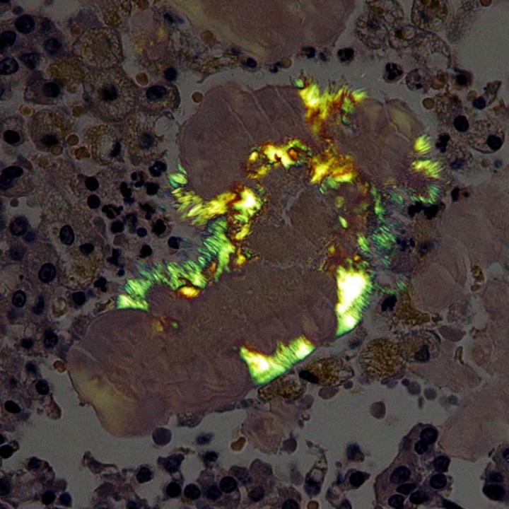 NEEDLE-SHAPED AMYLOID IN RAT MAMMARY GLAND (GREEN BIREFRINGENCE)