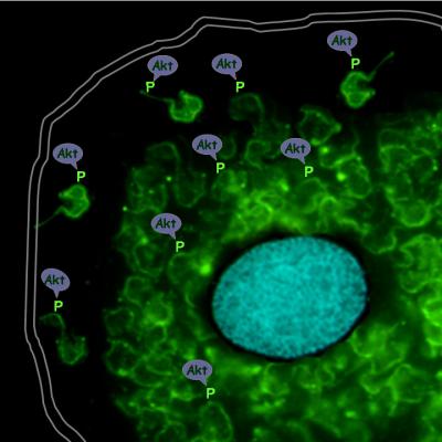 A Human Cell Infected With <I>Trypanosoma cruzi</i>