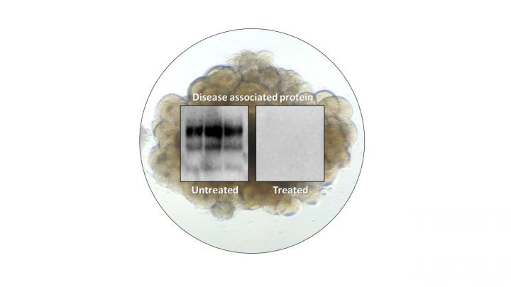 A cerebral organoid shown overlaid with test results from prion infected organoids that were left untreated or treated with PPS.