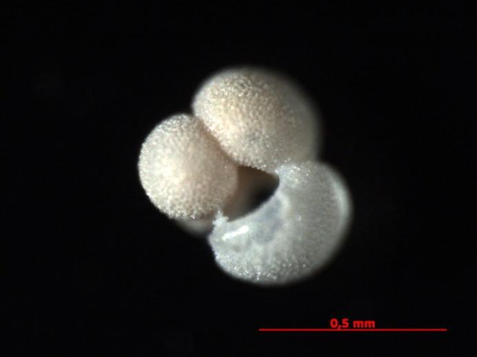 Reflected Light Image of the Shell of a Fossil Planktic Foraminifera Globigerinoides Ruber