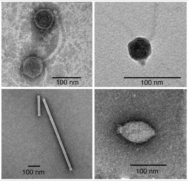 Viruses Observed in the Basement