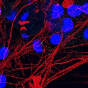 Motor neurons with damaged primary cilia (green) from patients with the C21orf2 mutation