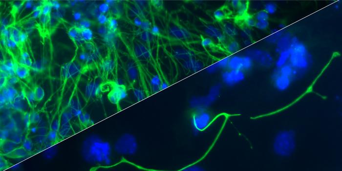 Comparison of neuronal differentiation in wild type embryonic stem cells (upper image) and embryonic stem cells where KAT6B has been deleted (lower image).