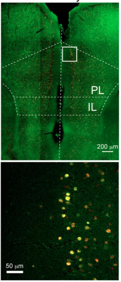 Neuron Hyperactivation in the Brain Leads to Depression
