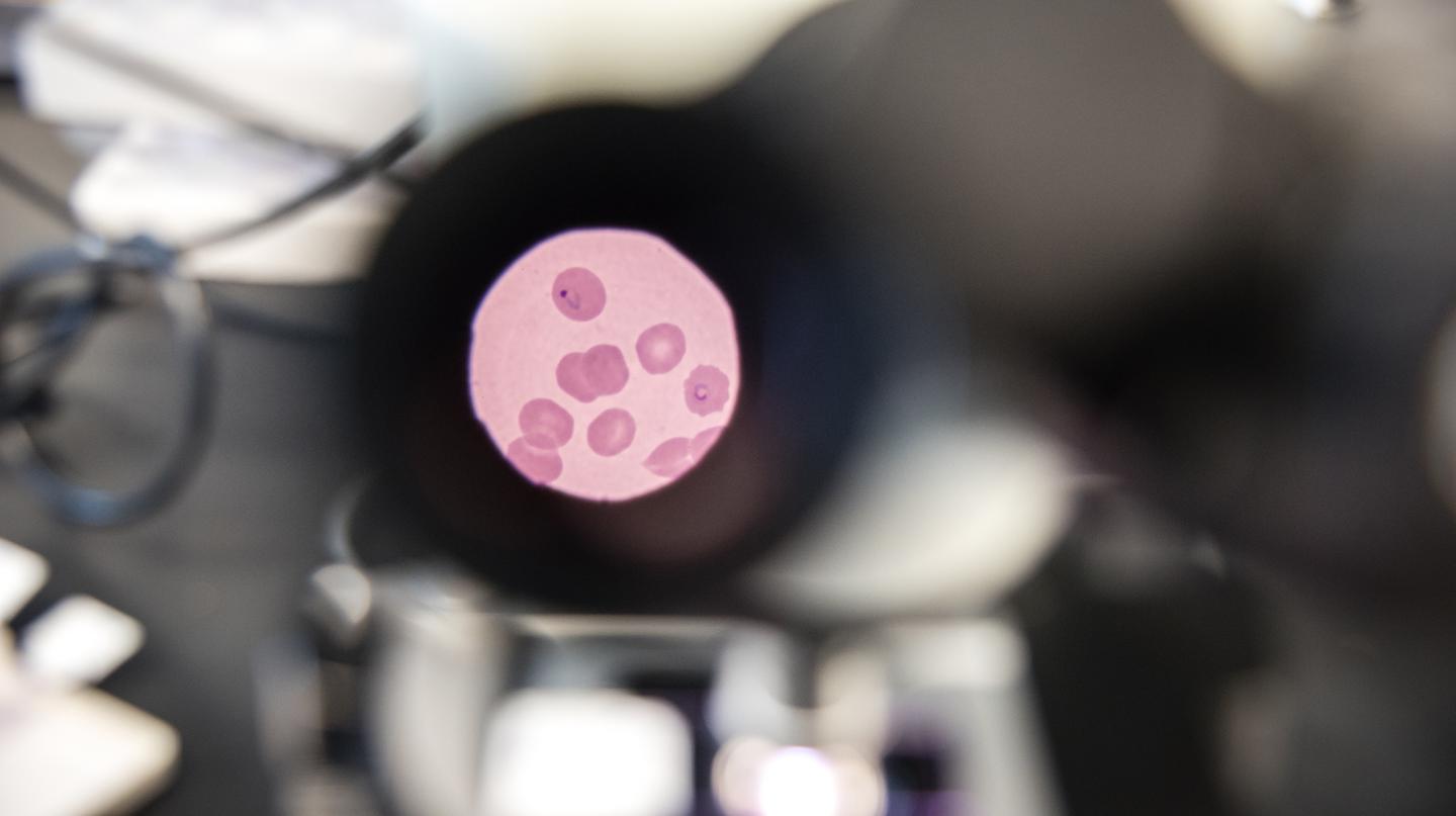 <em>Plasmodium falciparum</em>