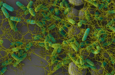 <I>E. coli</I> Colonizing a Textured Surface