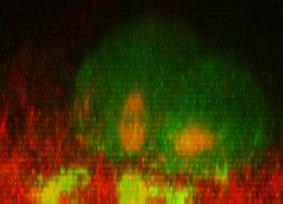 Cells Making Invadopodia