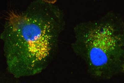 New Vaccine Strategy