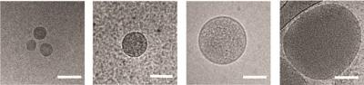 Nanovesicles Released from Red Blood Cells Infected by <i>Plasmodium falciparum</i>
