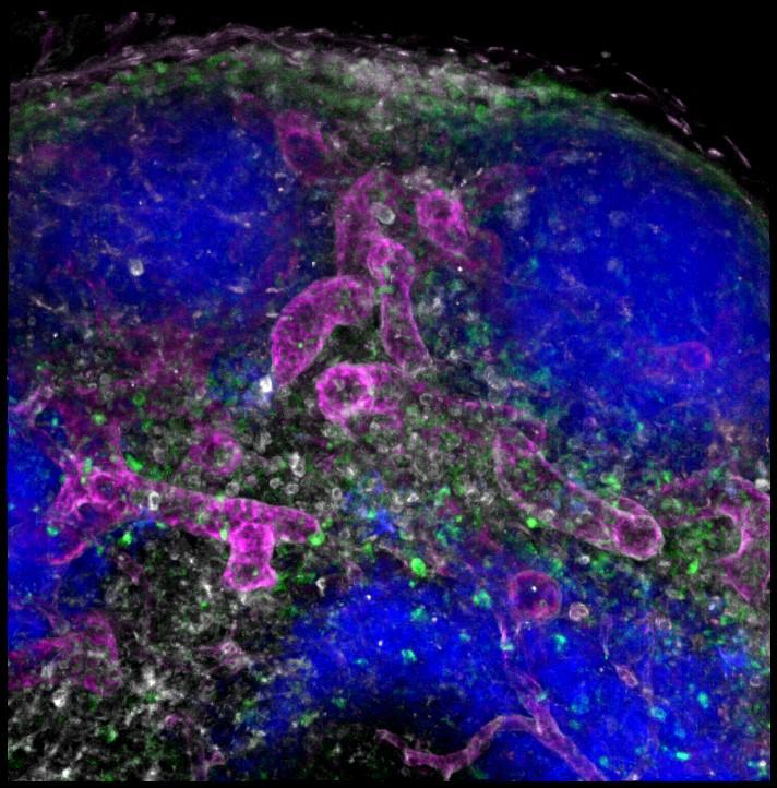 Subcutaneously Administered Antibodies Transported into the Lymph Node