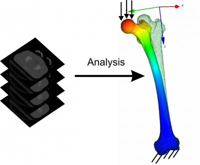 Bone Analysis