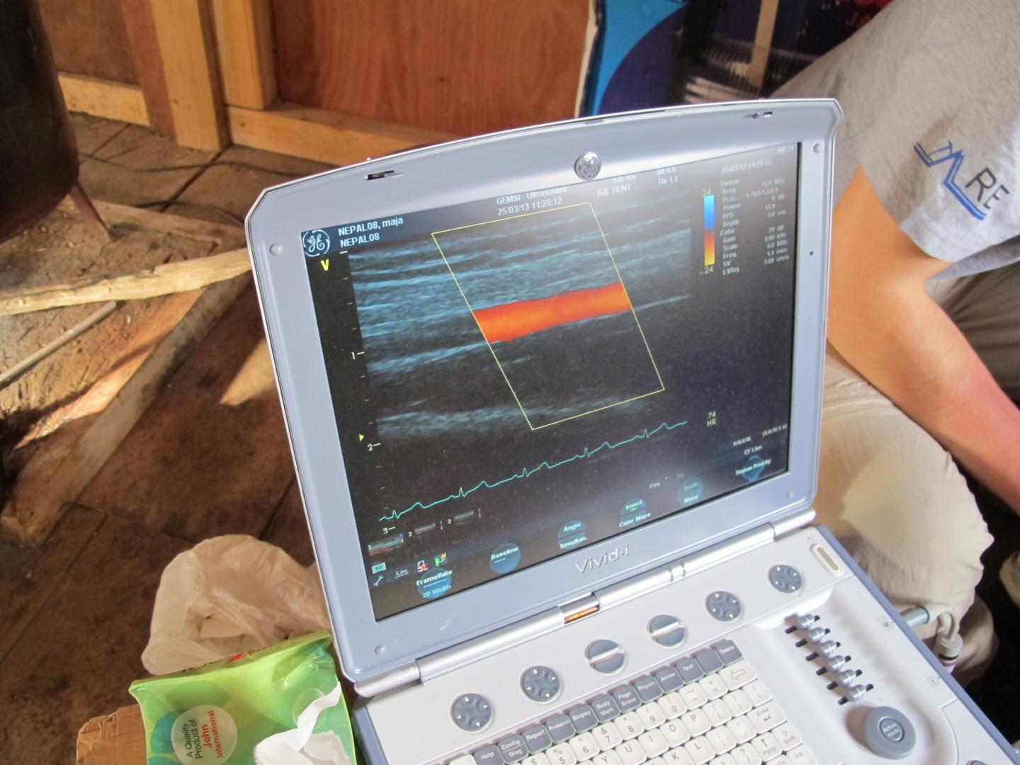 Ultrasound Measurements of Blood Vessel Function