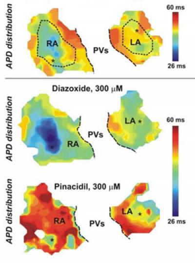 Optical Maps of Drug Response of Mouse Hearts