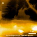 Mature hippocampal neuron -- ATM