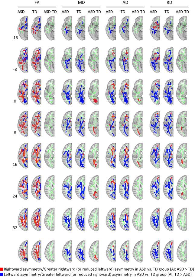 Division of Labor in Brains