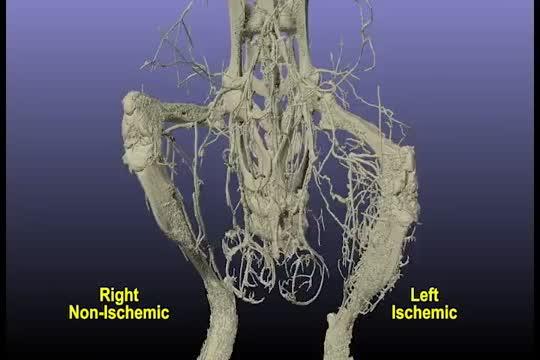 マイクロX線CTで撮影したマウス下肢欠陥の三次元画像