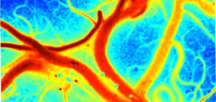Multi-Exposure Speckle Imaging (MESI)