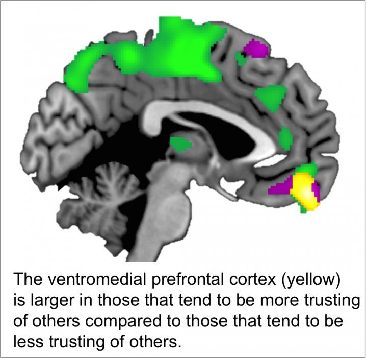 Brain Scan