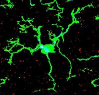 A Microglia Cell (Green) Surrounded by Synapses (Red)