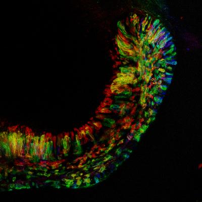 Researchers Visualize Mouse Dental Stem Cells in Rainbow Colors