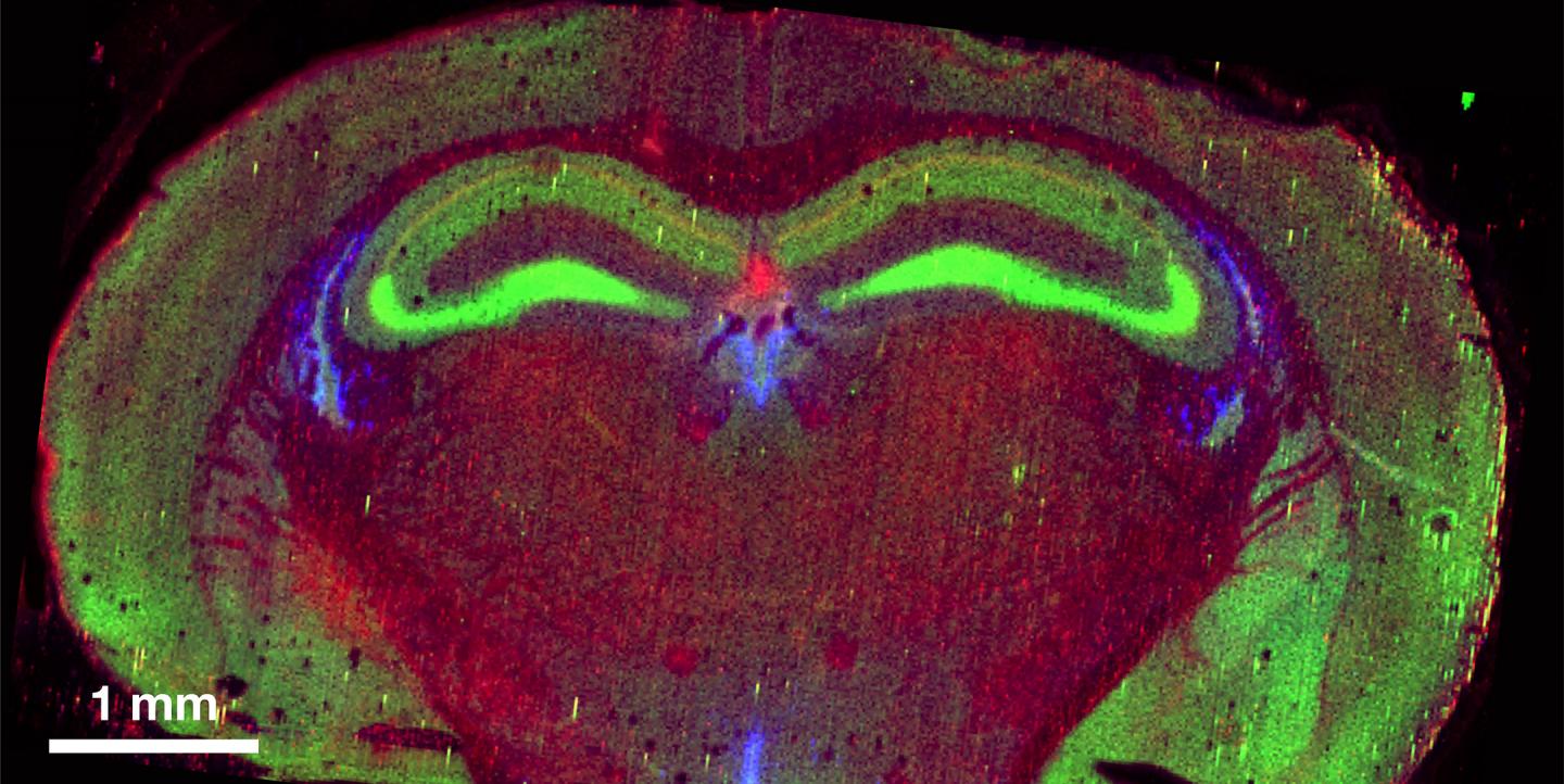 Quantitative Elemental Maps of the Mouse Brain Obtained Via LA-ICP-TOF-MS